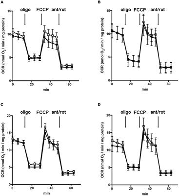 Histone Acetylation Defects in Brain Precursor Cells: A Potential Pathogenic Mechanism Causing Proliferation and Differentiation Dysfunctions in Mitochondrial Aspartate-Glutamate Carrier Isoform 1 Deficiency